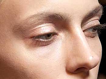 Sguardo stanco e appesantito? Può essere per mancanza di sole Sguardo stanco e appesantito? Può essere per mancanza di sole