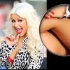 �Buccia d'arancia� come Christina?