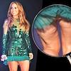 Cellulite alla Jennifer Lopez?