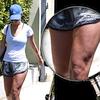 �Fibrosa� come Katy Perry?